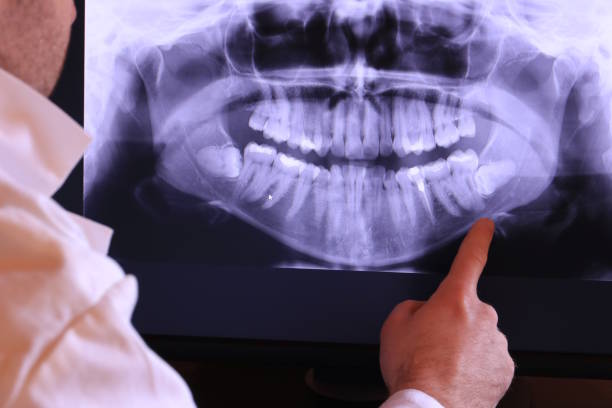Best Weekend Emergency Dentist in Snow Hill, MD